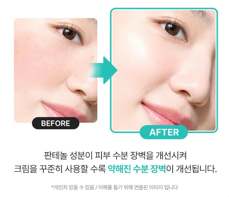 닥터지-비포-애프터-이미지-출처-올리브영