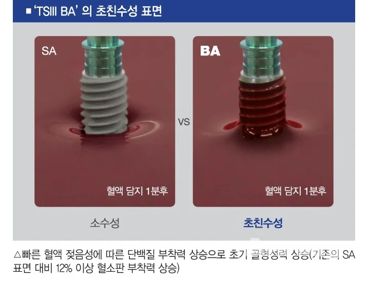 오스템 TS3 BA 임플란트의 친수성표면
