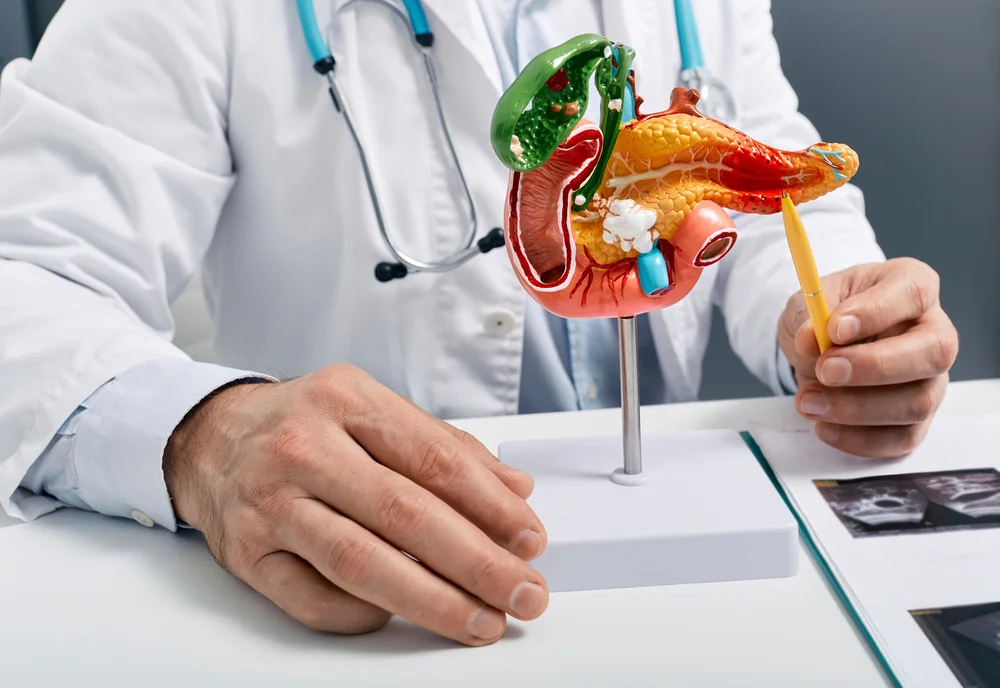 췌장암 초기증상 | 힐링오아시스