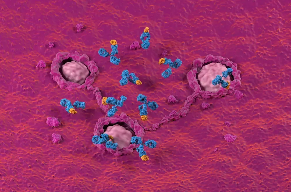 대장암 초기 증상 자가진단 체크리스트
