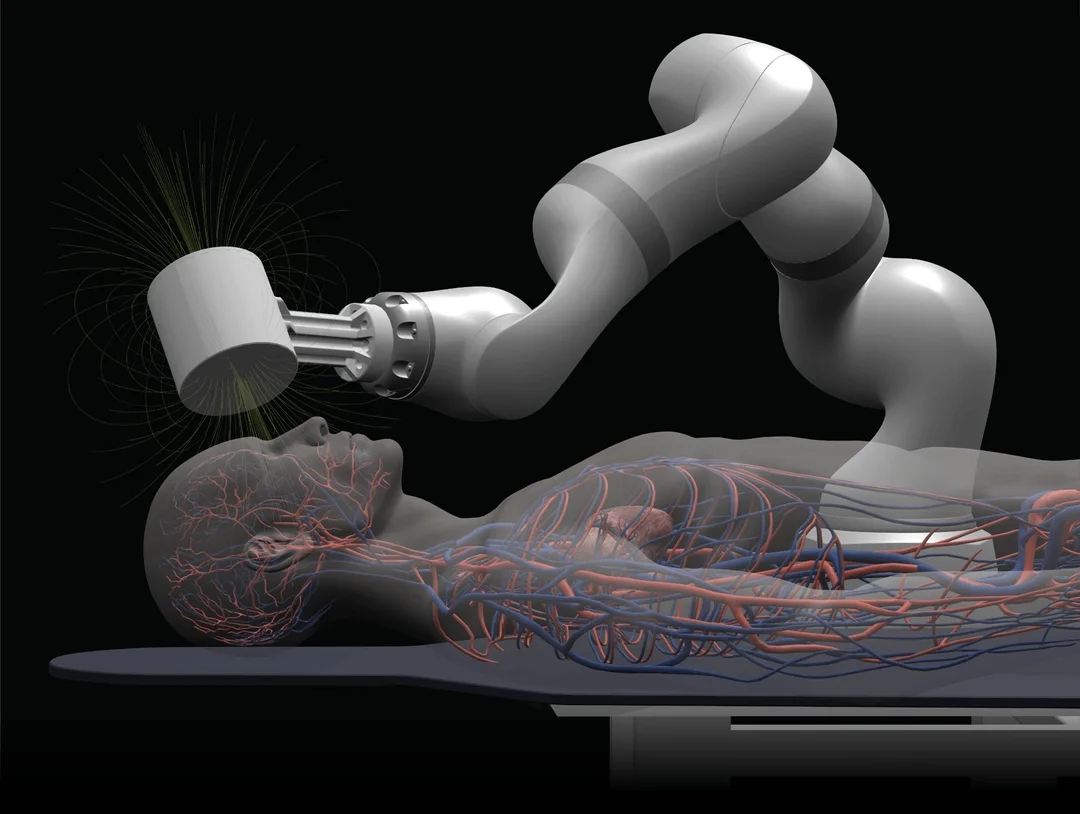수술대에 누운 환자의 뇌혈관을 로봇 팔이 정밀하게 조작하는 장면을 표현한 이미지로, 뇌혈관 중재술에서 의사의 손기술을 보조하는 로봇 플랫폼 개념을 보여준다.