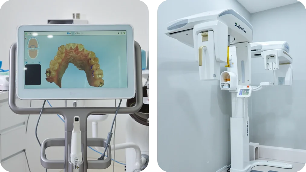 인비절라인 교정에 필요한 의료기기 이미지