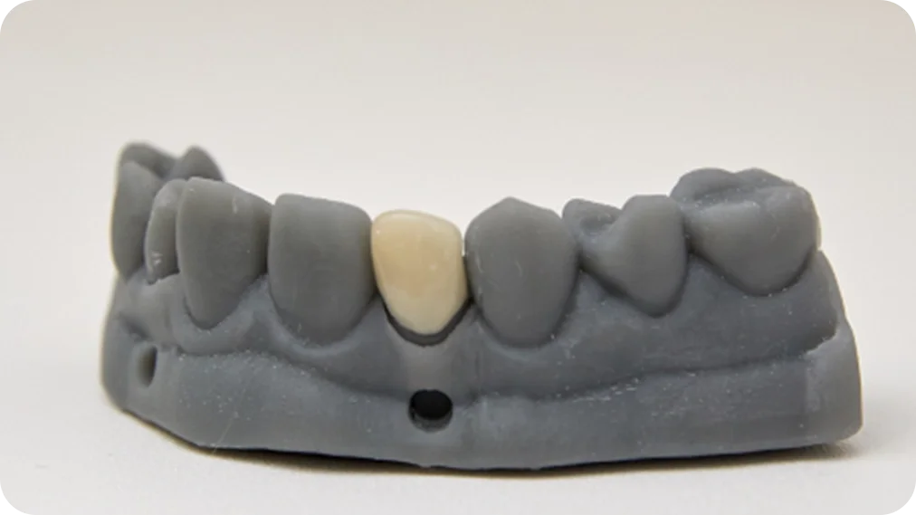 불당동치과_치아이미지