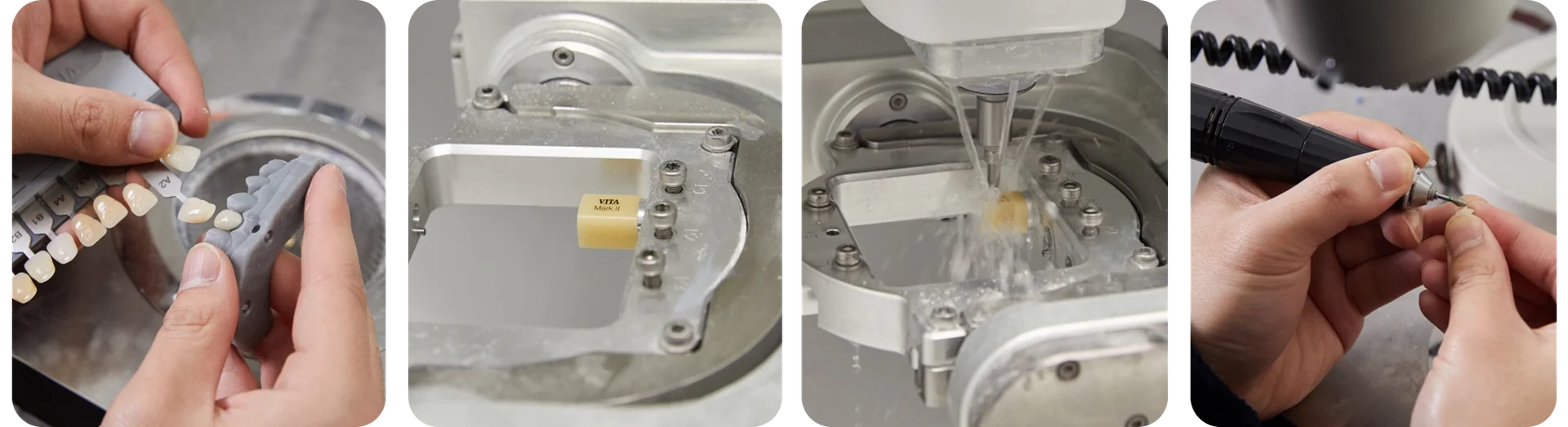 라미네이트치료과정이미지