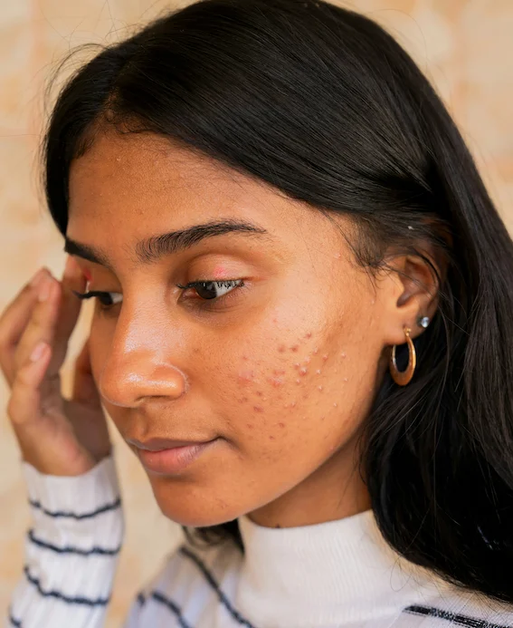 woman with sensitive skin