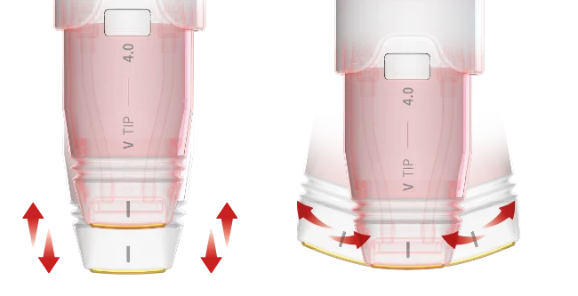 볼뉴머 팁 표면/헤드 