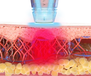 볼뉴머 임피던스 체킹 시각화 이미지