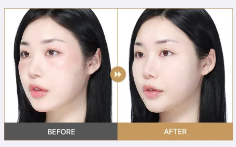 Photos before and after using the Papa Recipe Pack & Foam
