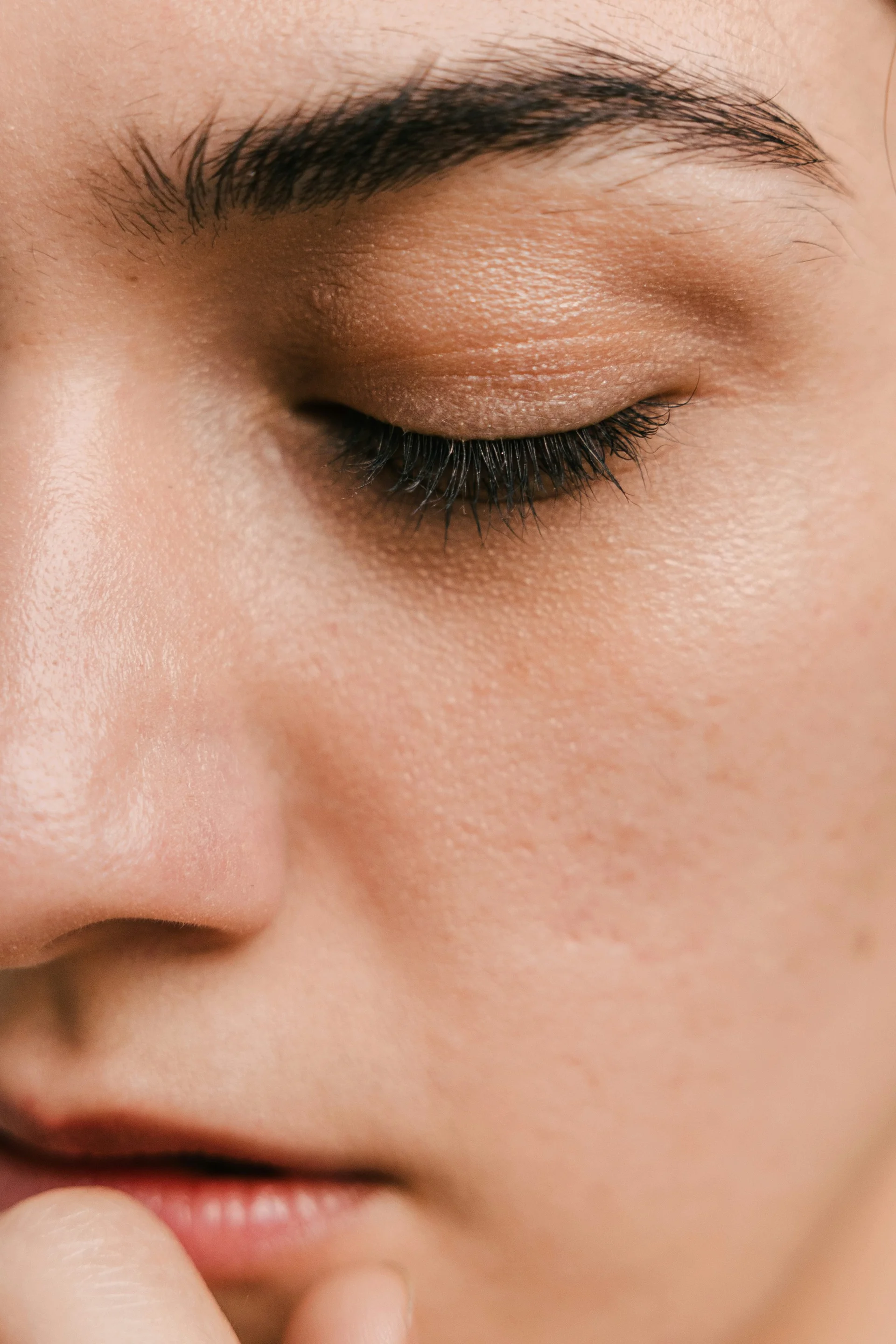 고주파 리프팅 받기 전 피부상황