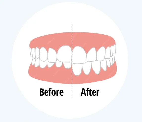 부정교합 이미지