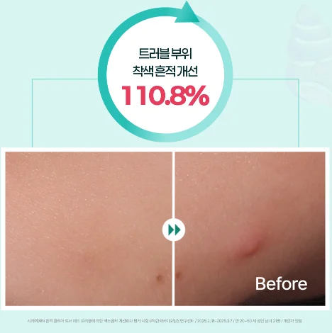 [시카 pdrn 토너 패드 전후] 트러블 부위 착색 흔적 