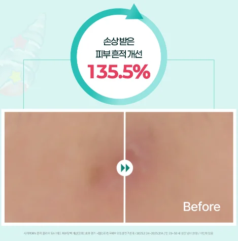 [시카 Pdrn 토너 패드] 손상 받은 피부 흔적 개선 