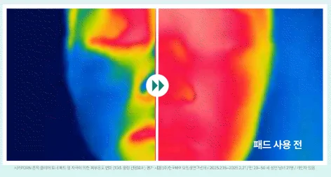 [시카 pdrn 토너 패드 전후] 피부 온도 변화