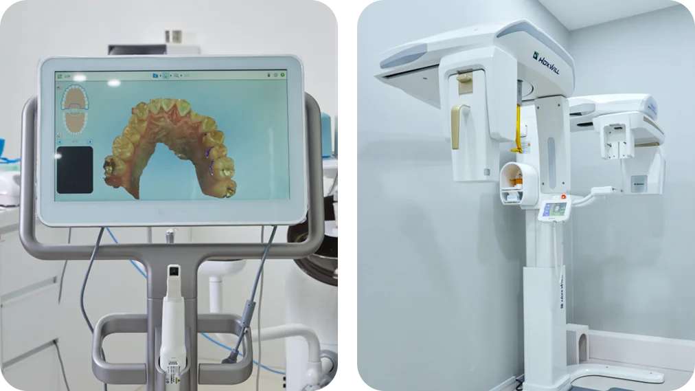 천안치과 서울비디치과 교정 3D 진단