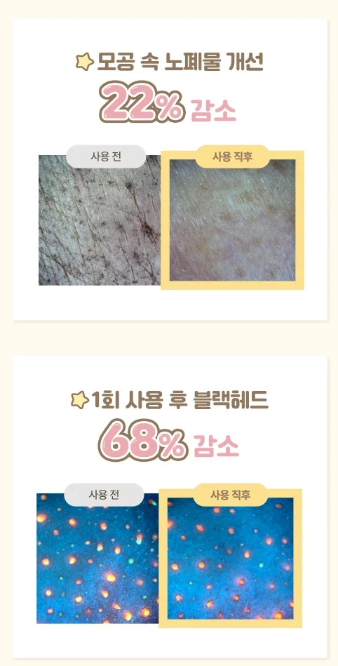 아이레시피 세라마이드 클렌징 오일 임상 결과 