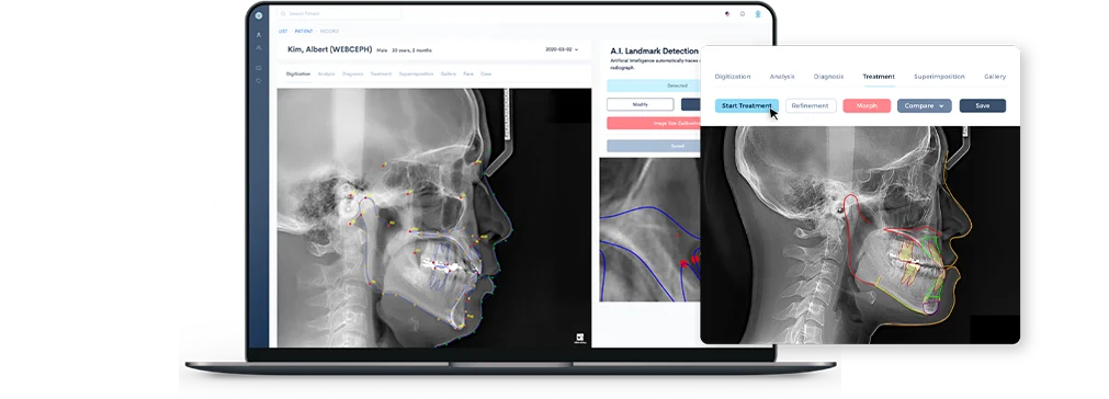 인비절라인 교정을 위한 디지털 구강 스캔 과정