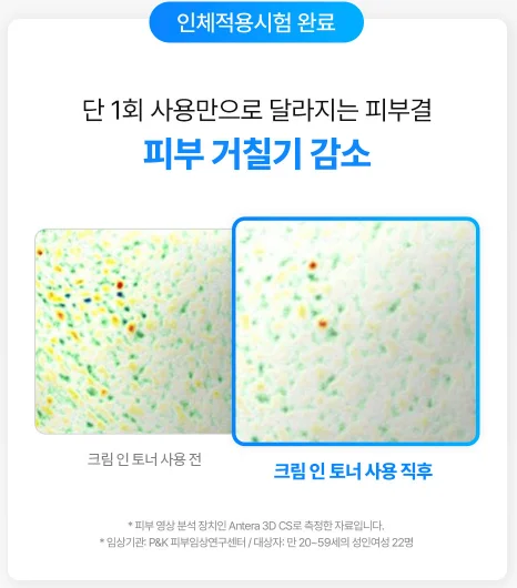 아쿠아 피토플렉스 크림인토너 미스트: 피부 거칠기 임상 결과 