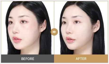 Before and after : using Papa Recipe Pack and Foam