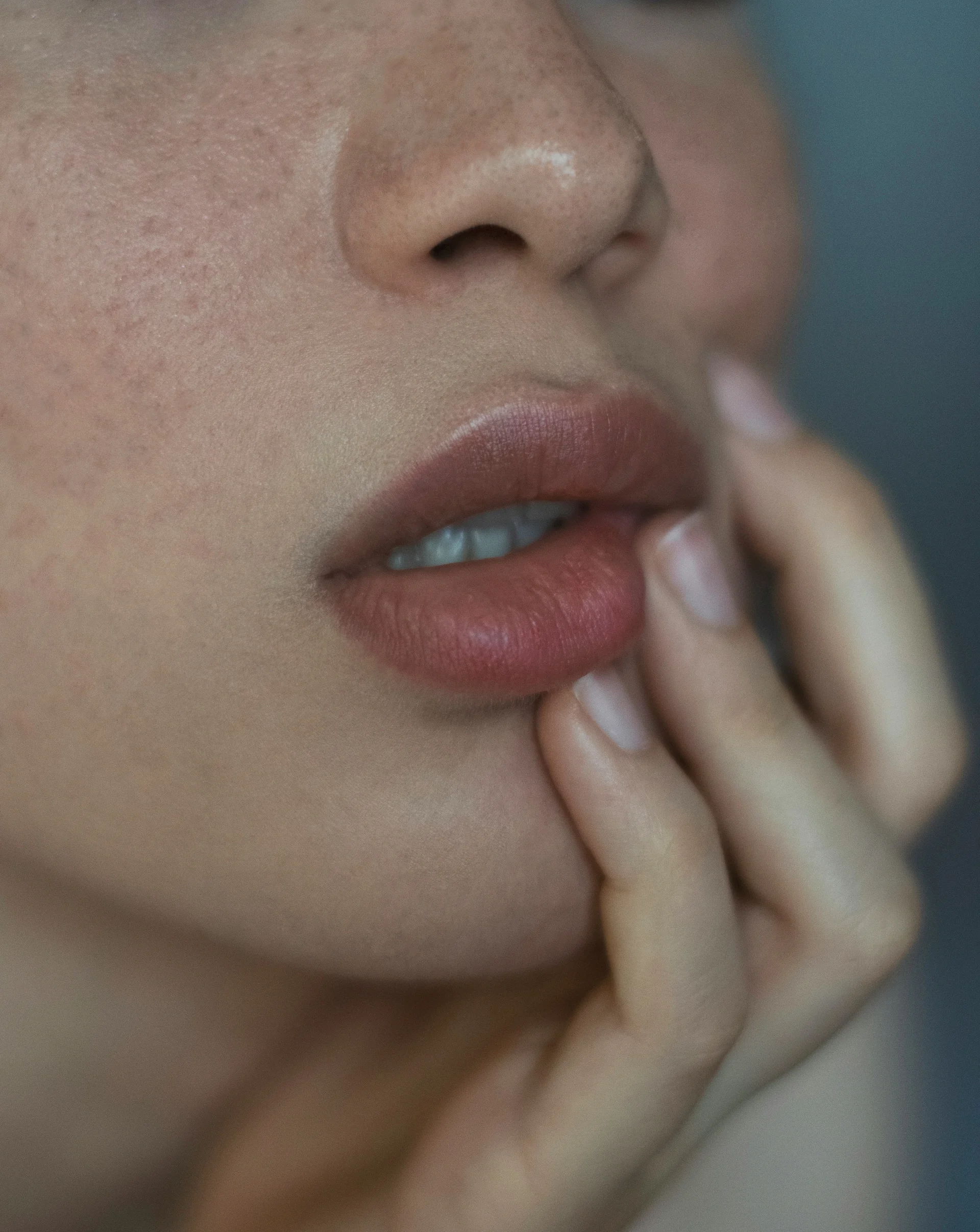 얼굴처짐으로 리프팅을 고민중이 여성