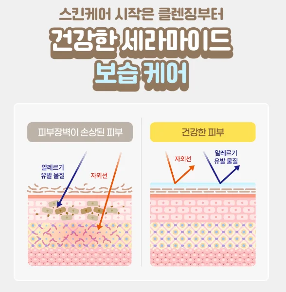 피부 장벽이 손상된 피부를 설명하는 이미지 