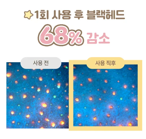 아이레시피 유자 바이오 클렌징 오일 사용 전후 - 블랙헤드 개선 이미지 