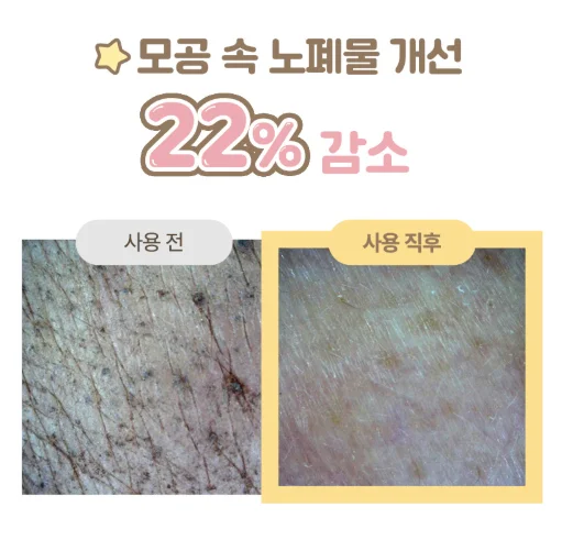 아이레시피 유자 바이오 클렌징 오일 사용 전후 - 모공 속 노폐물 개선  