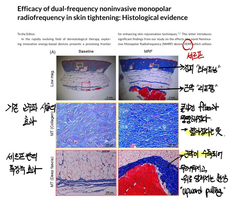 Xerf - Evidence from Histological Research