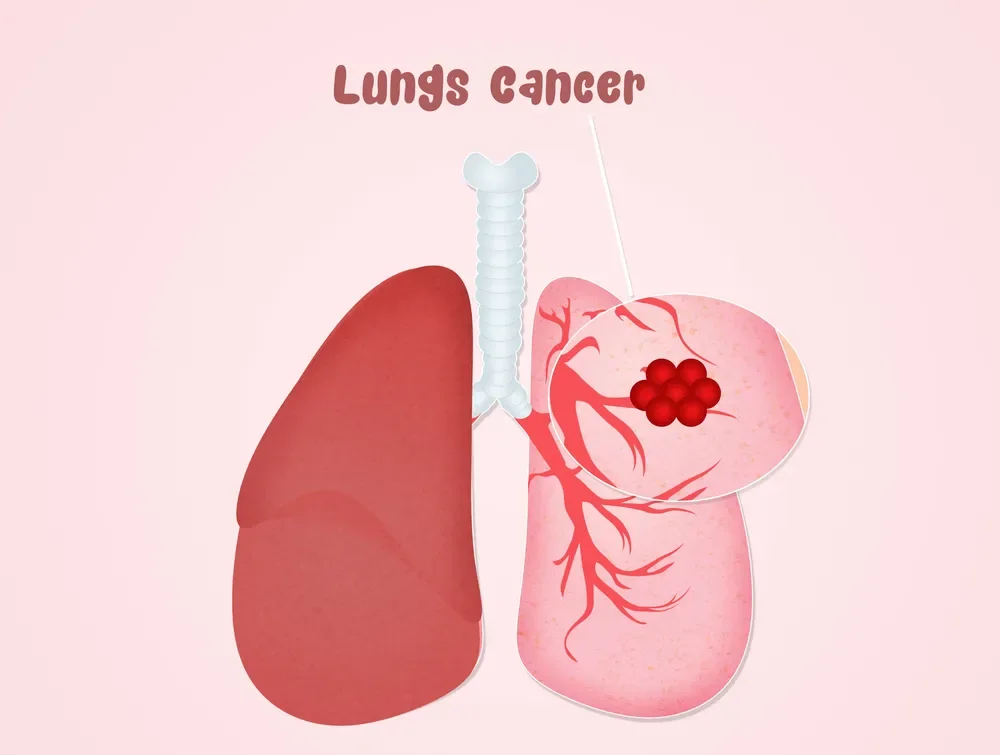 암요양병원 찾기 | 힐링오아시스