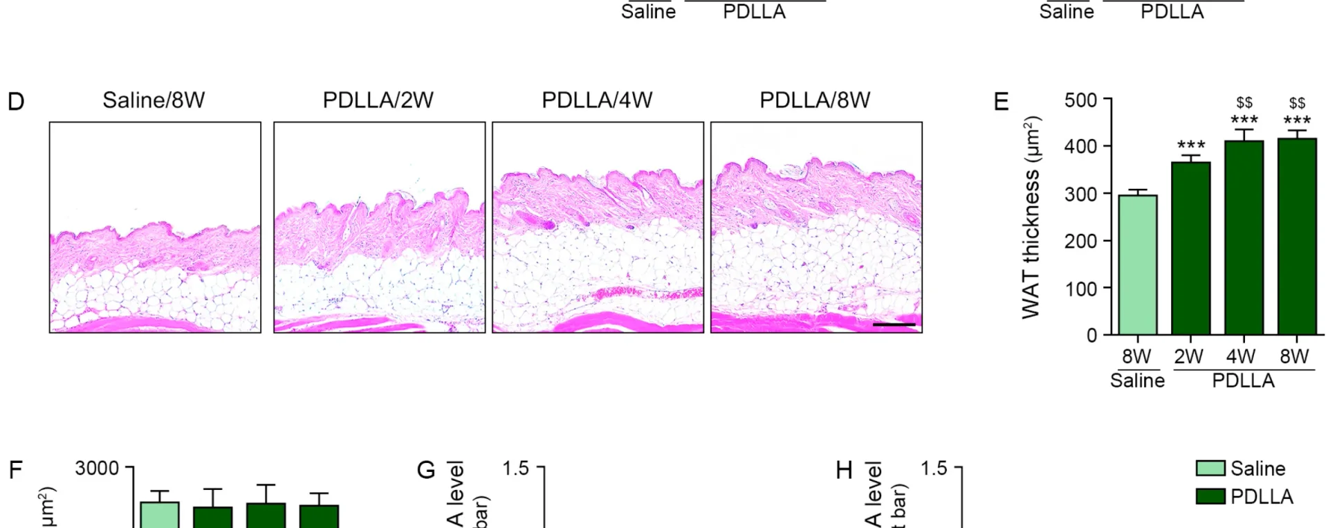 Fat thickness after juvelook volume treatment