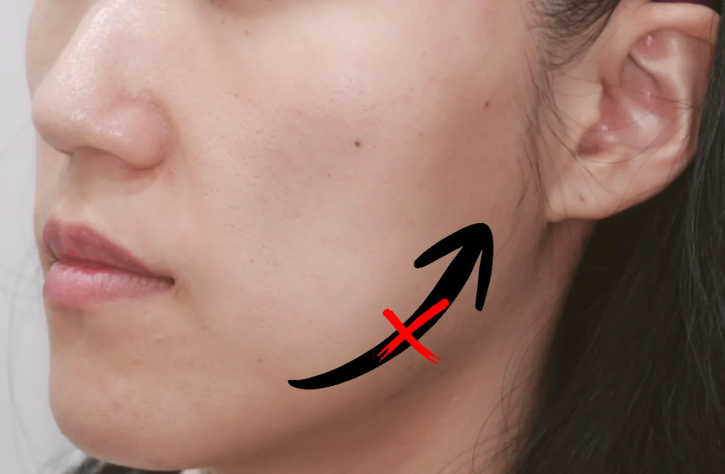 Actual Effects of Lifting Treatments