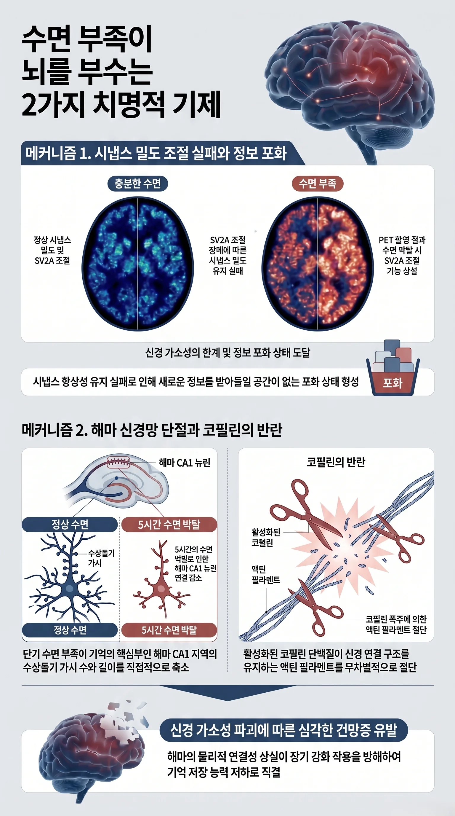 면 부족이 뇌를 부수는 2가지 메커니즘을 설명하는 모바일 인포그래픽 (인간 뇌의 시냅스 밀도 조절 장애  및 코필린 단백질 폭주로 인한 해마 신경망 단절 기전 시각화