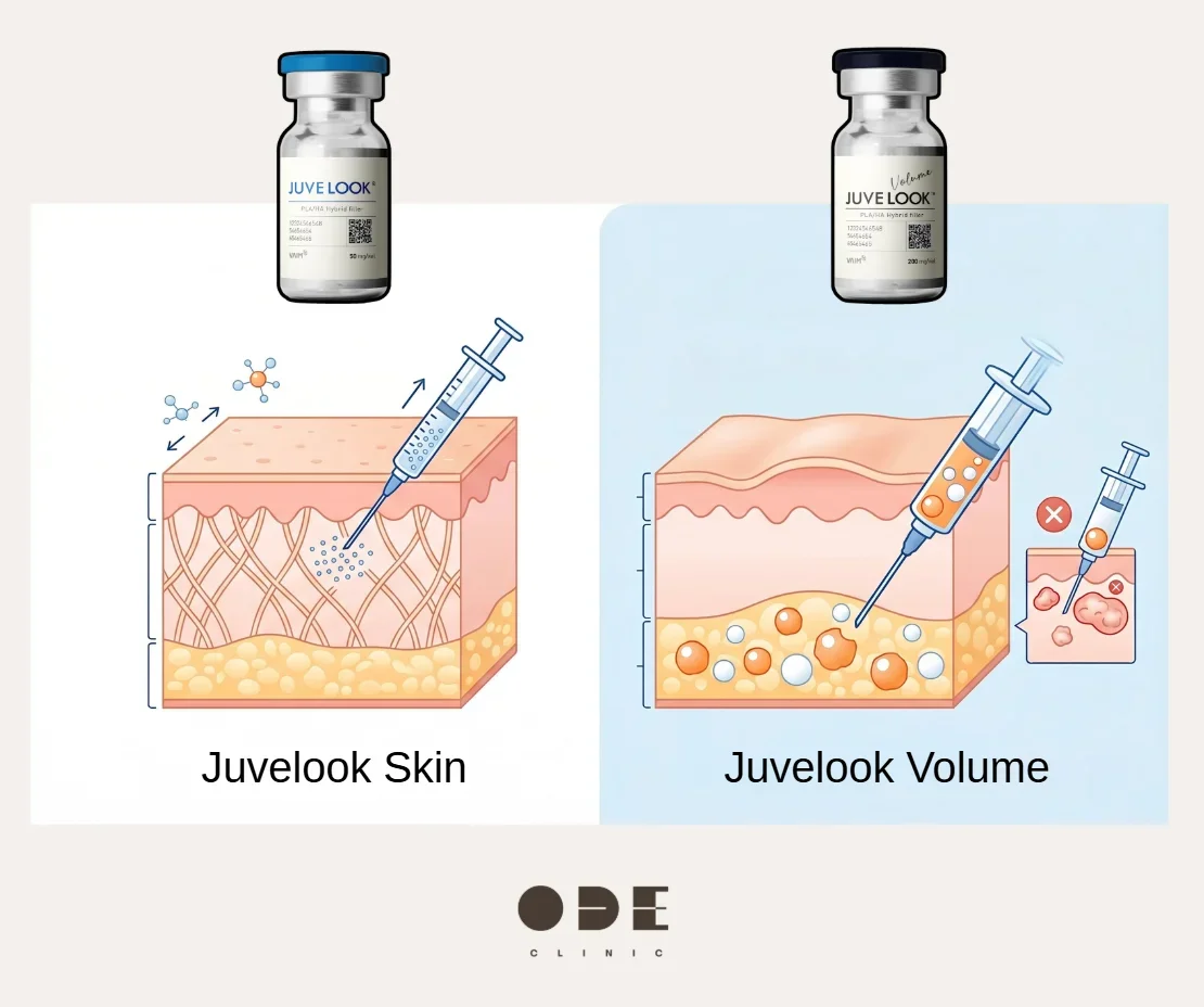 Injection Layers of Juvelook Skin and Juvelook Volume