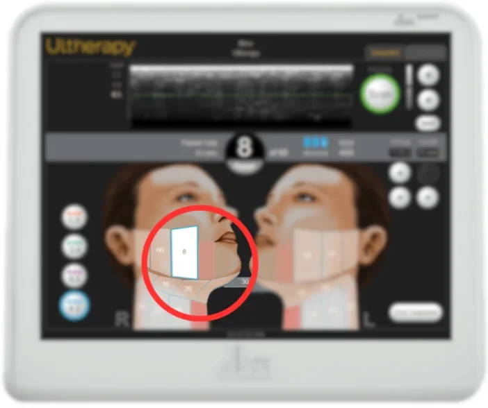 Ultherapy Device Screen