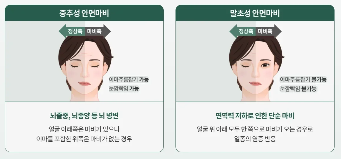 365매일한방병원 | 안면마비 치료