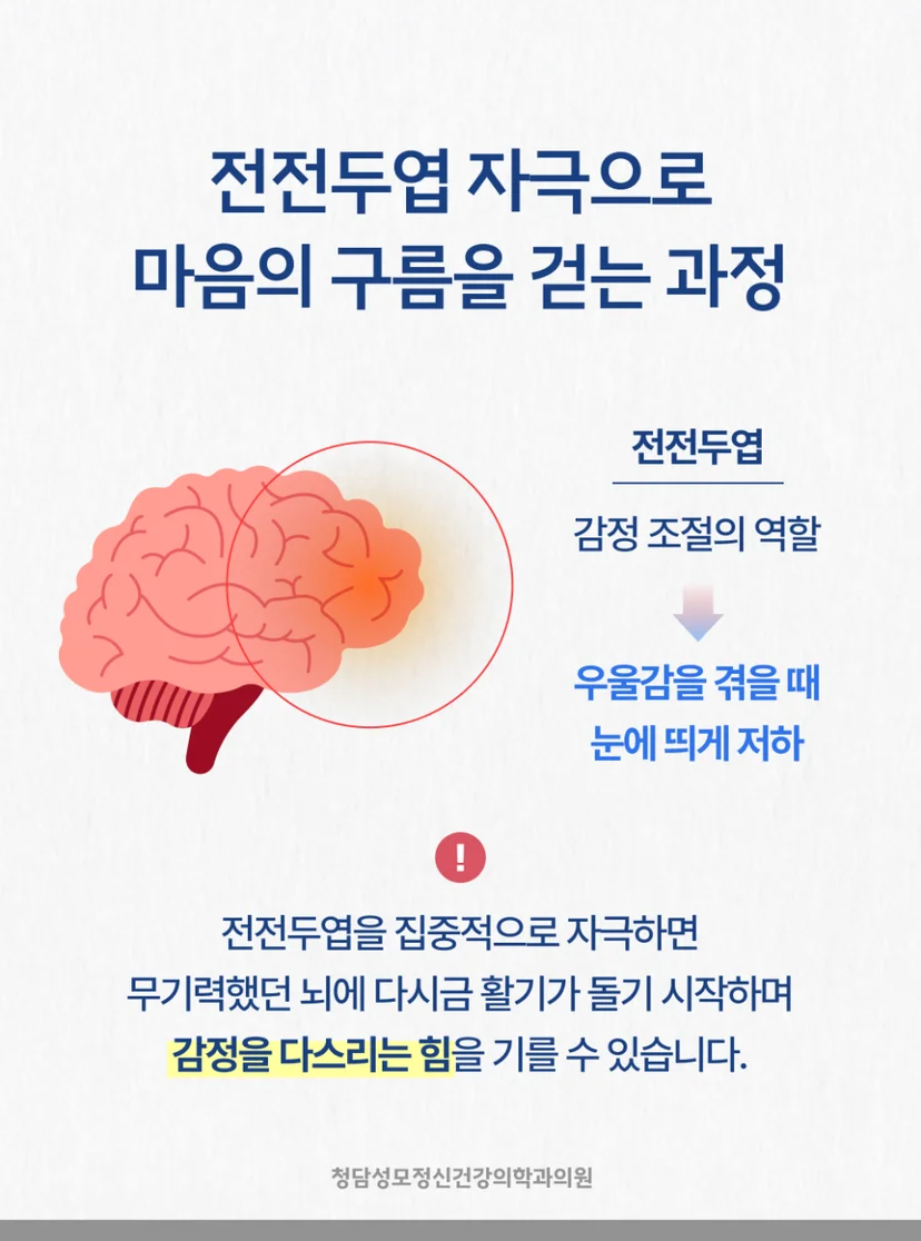 TMS 전전두엽 자극