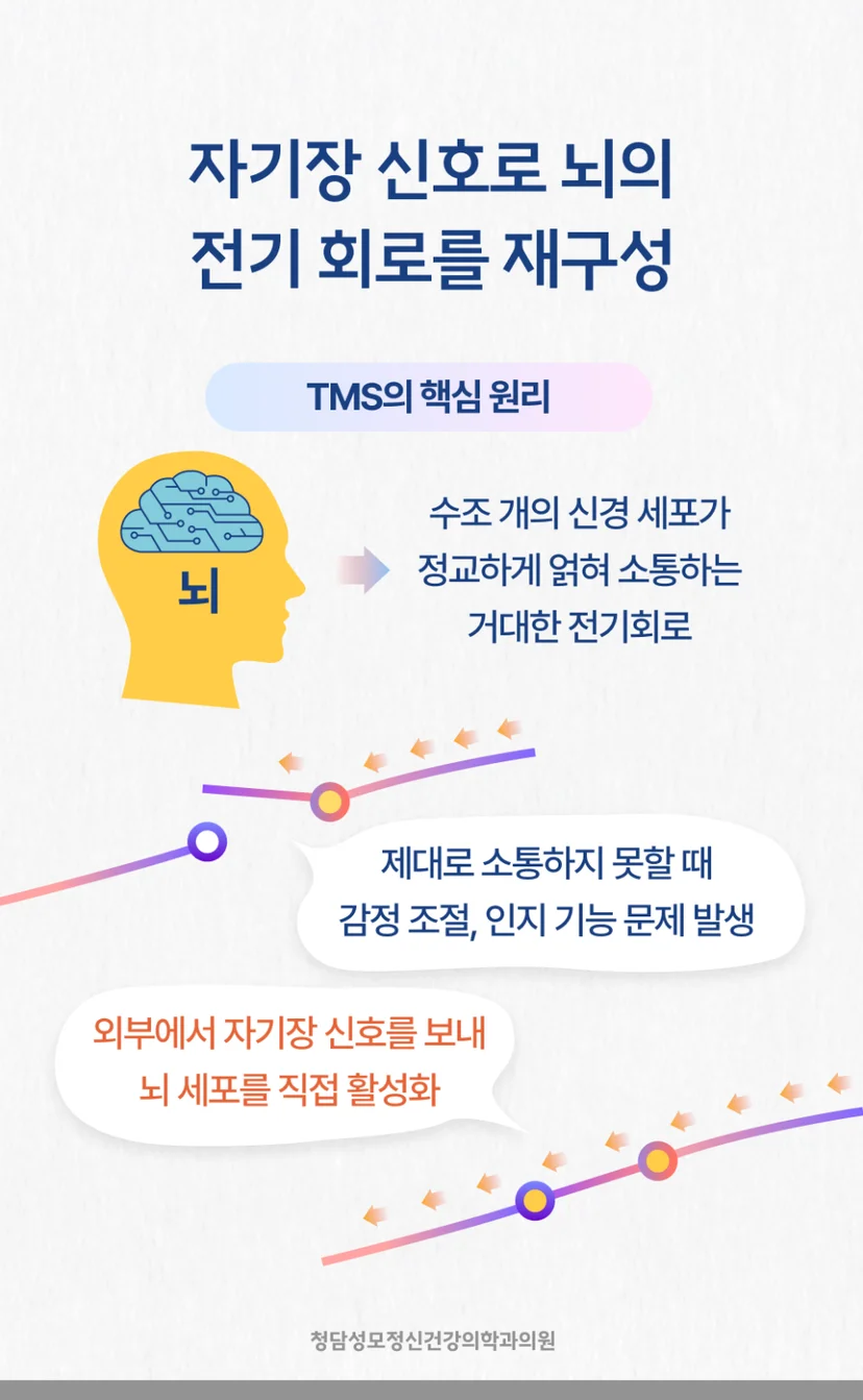 TMS 치료원리