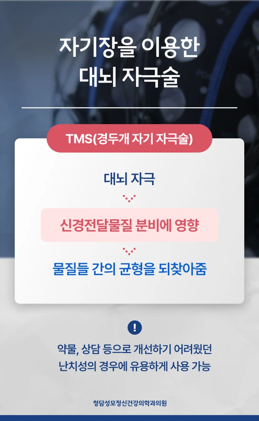 TMS 특징