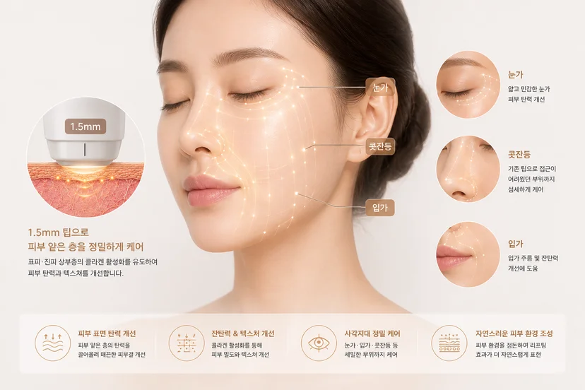 눈가울쎄라 콧잔등울쎄라 입가울쎄라 1.5팁 커버핏울쎄라로 가능