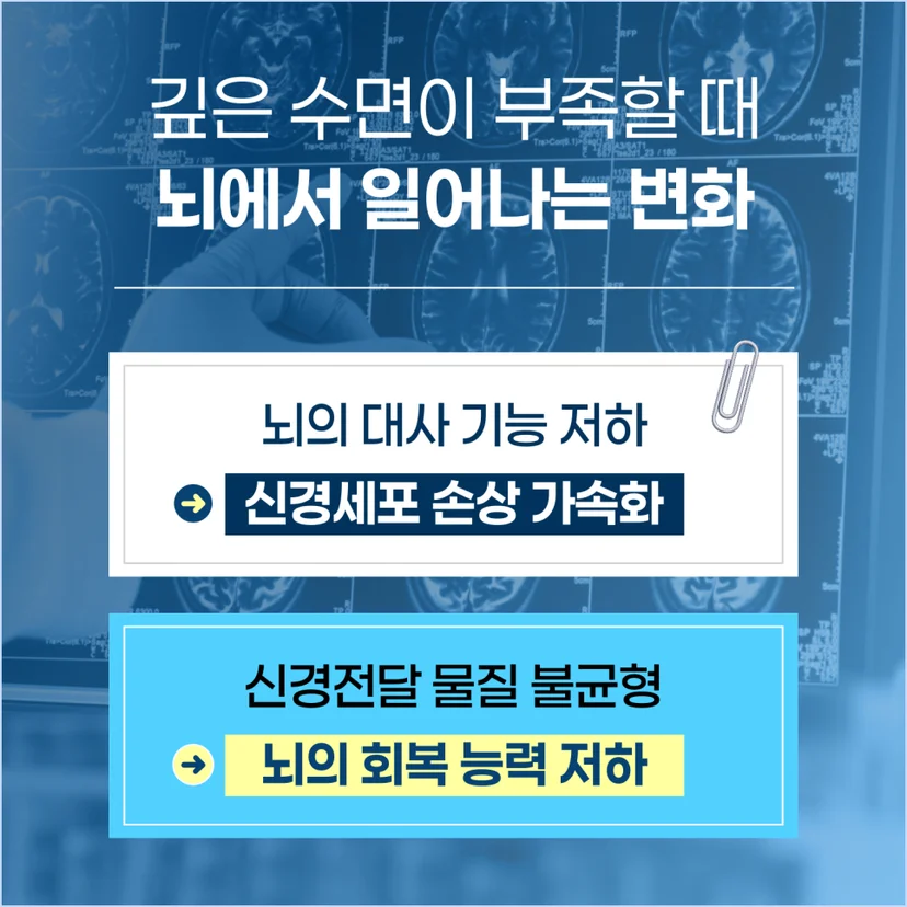 수면부족이 뇌에 미치는 영향