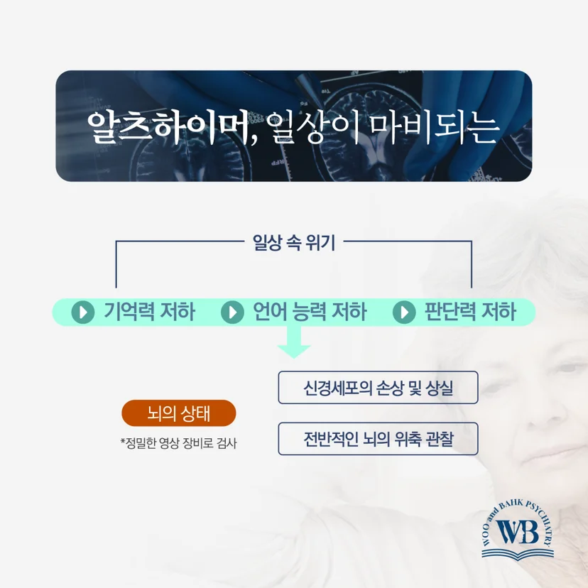 일상이 마비되는 알츠하이머