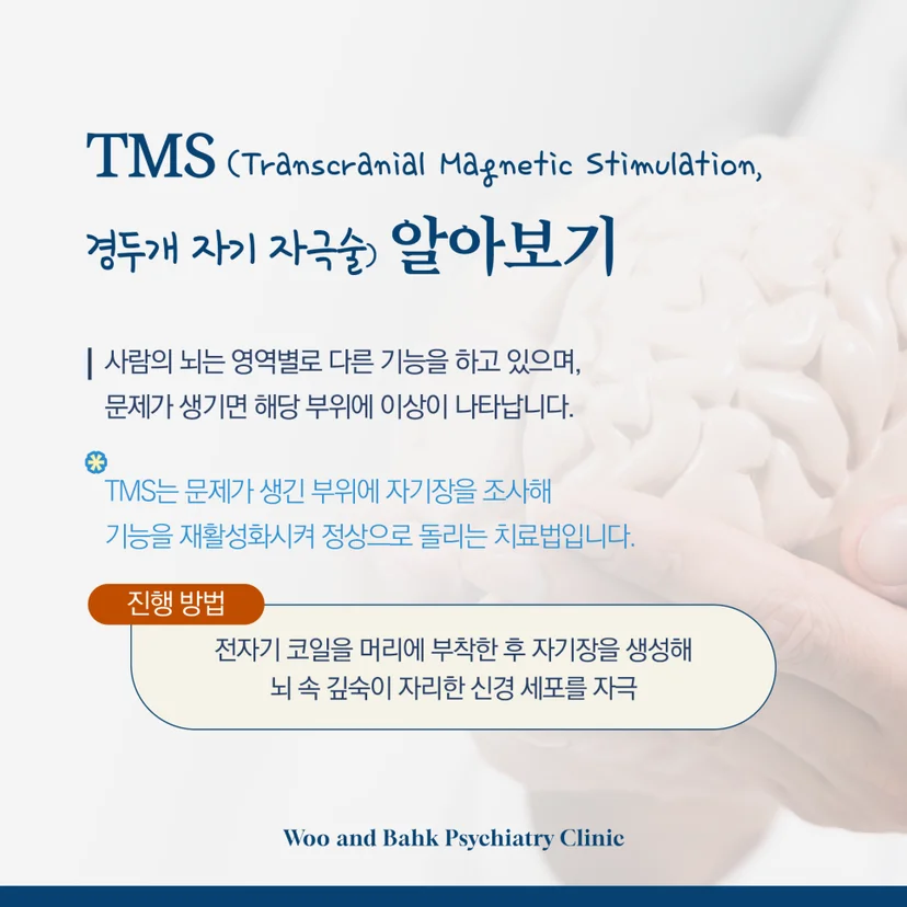 TMS 원리 및 역사 알아보기