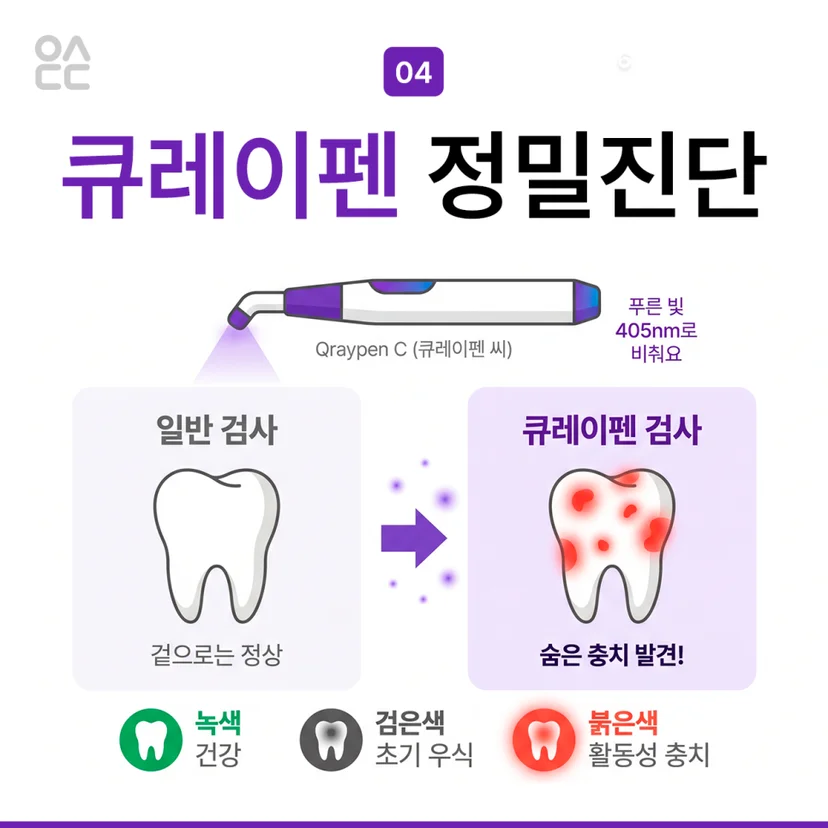 큐레이펜 정밀 진단