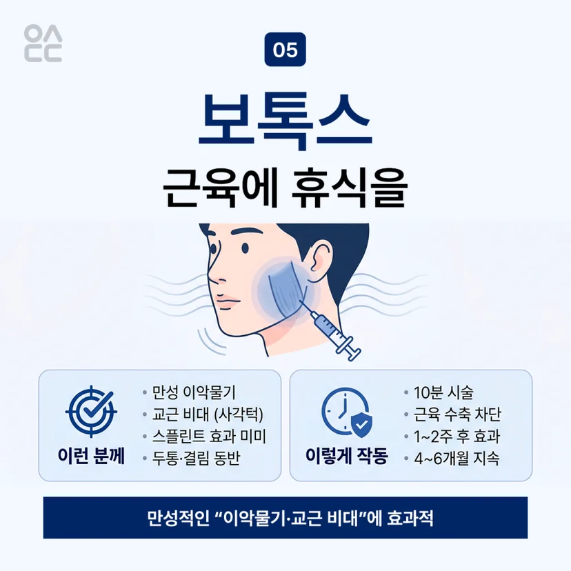 턱관절장애 보톡스