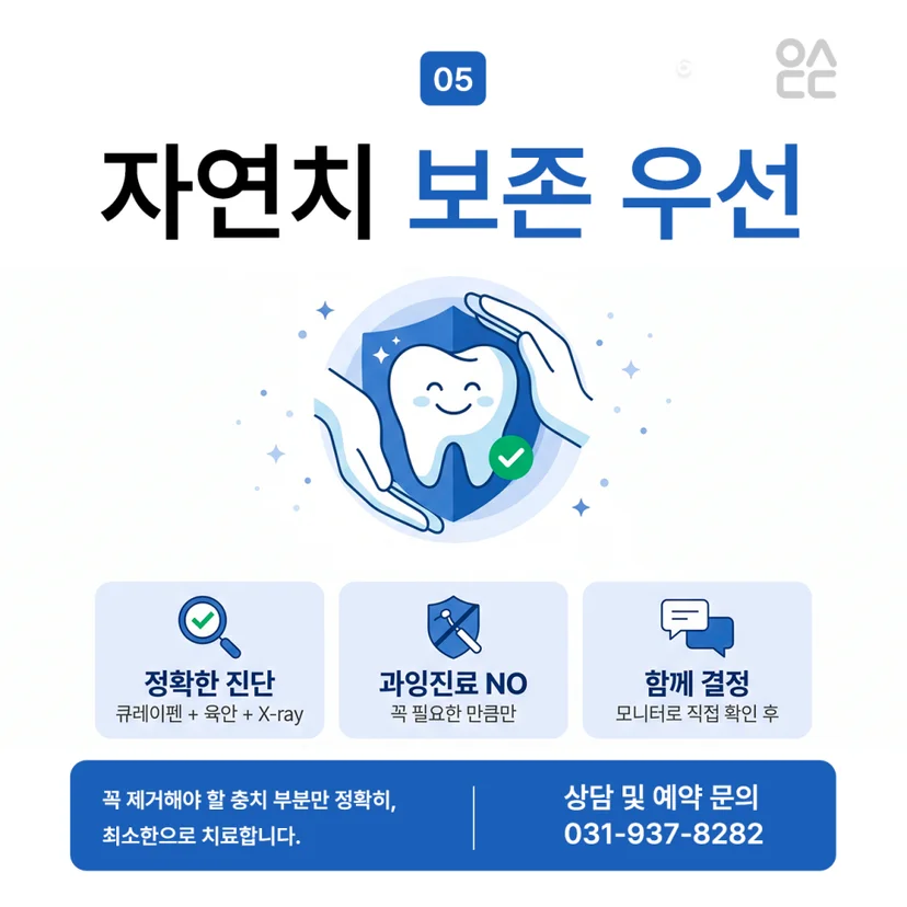 자연치아 보존 우선
