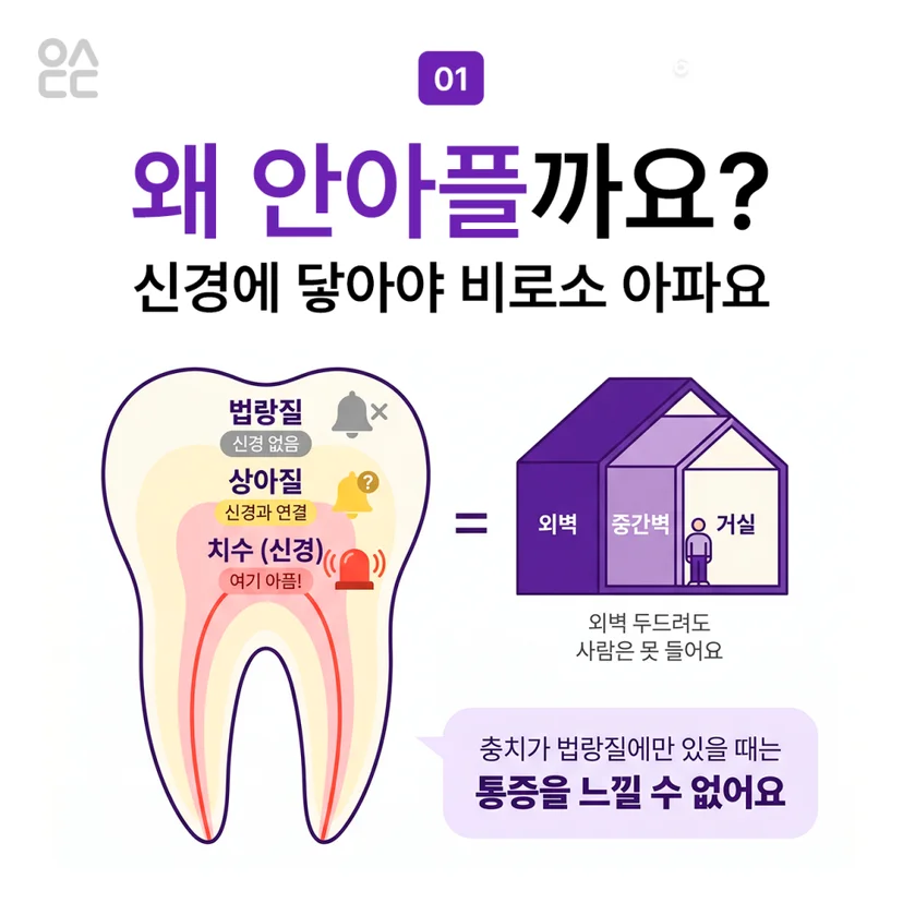 초기 충치가 안 아픈 이유