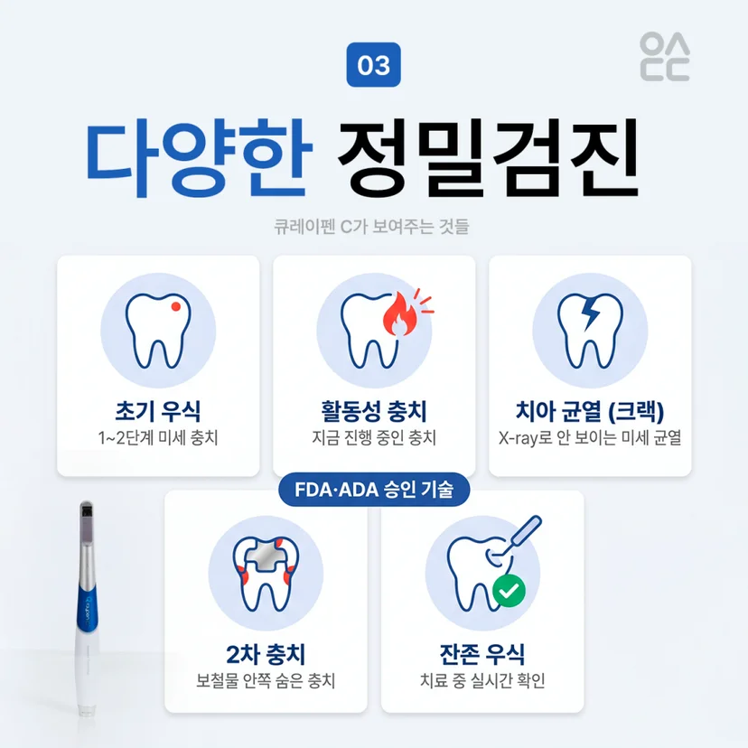 큐레이펜 C 정밀검진 기능