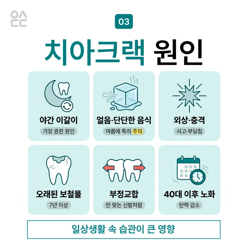 치아크랙 원인