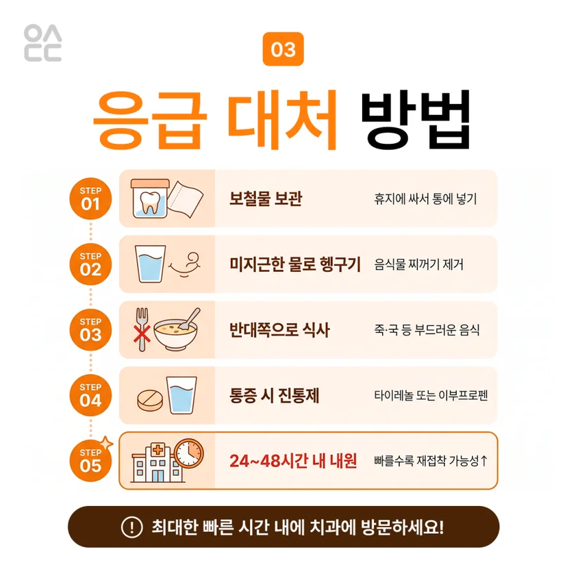 크라운 탈락 응급대처 방법