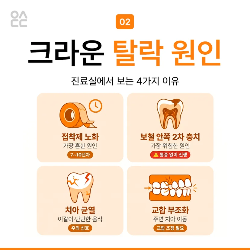 크라운 탈락 원인