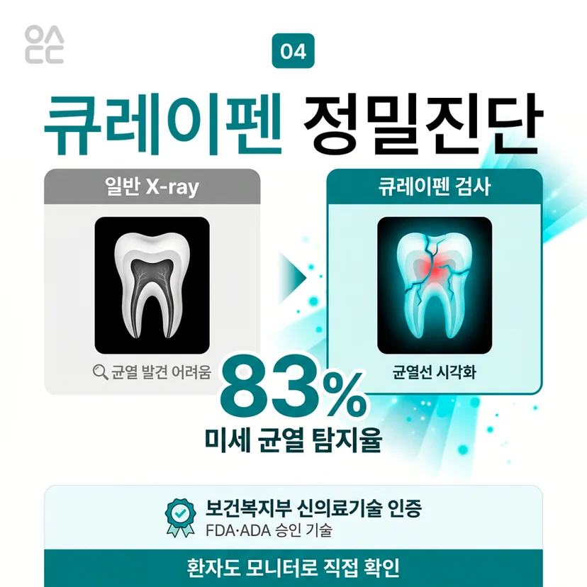 큐레이펜 정밀진단